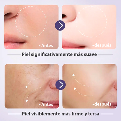 Set Bioaqua Retinol